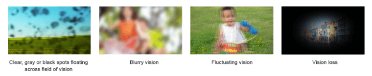 lifestyle-changes-are-key-to-preventing-diabetic-retinopathy-2