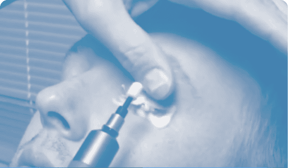 BLEPHEX® TREATMENT