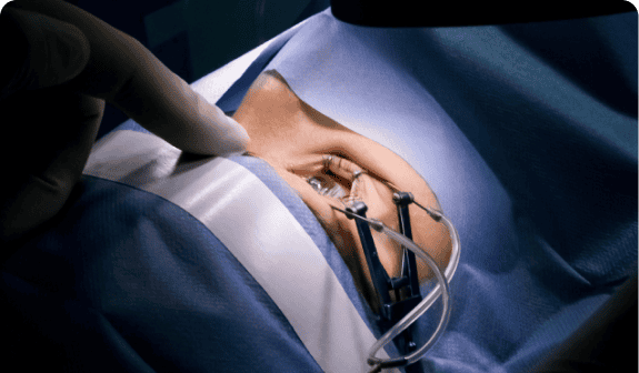 eye plastic surgery