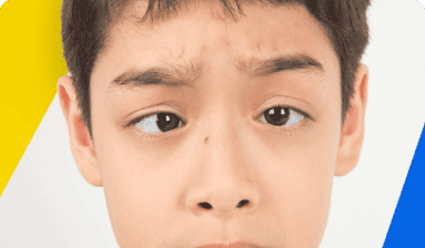 kid with misaligned eyes