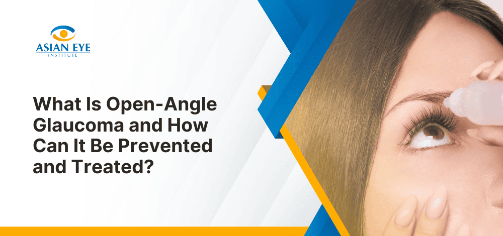 What Is Open-Angle Glaucoma and How Can It Be Prevented and Treated