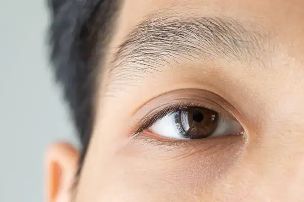 Young asian closeup for eye glaucoma checkup